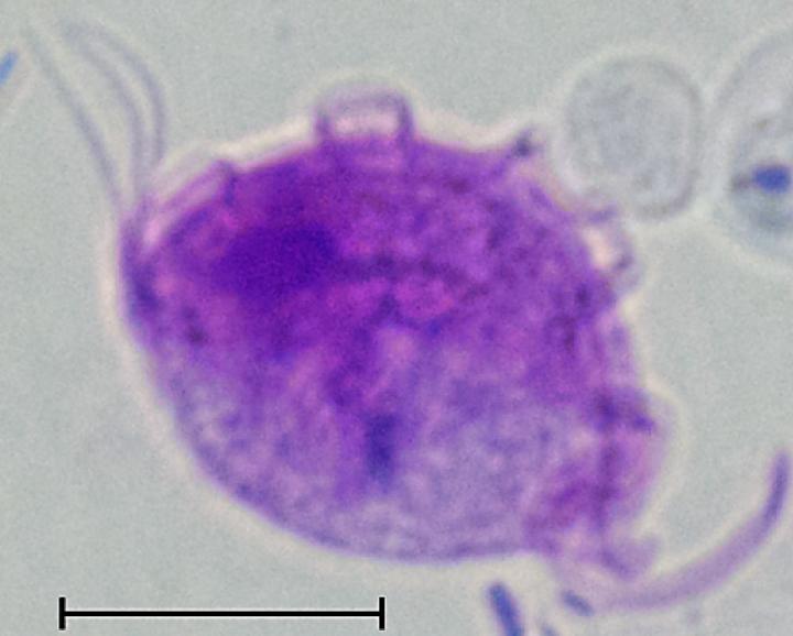 Researchers have discovered that the intestinal parasite Tritrichomonas muris (pictured) increases the susceptibility of its host to colitis. Image/Escalante et al., 2016