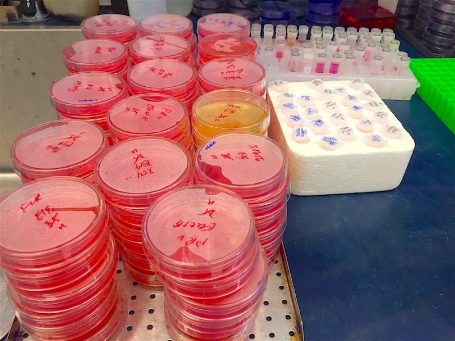 Plates of Vero cells used for Zika virus plaque assays being fixed in preparation for staining. Tube at right contain a variety of Zika virus isolates from all over the world/ Vincent Racaniello, PhD