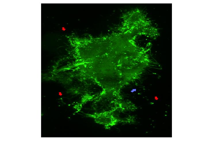 This is a confocal image of a live mammalian cell expressing a GFP-Ebola VP40 fusion protein (green). Strong fluorescence at the periphery, or cell surface, and the filamentous projections are indicative of budding virus-like particles from the cell surface. Image/PennVet Imaging Core (PVIC), directed by Bruce Freedman and managed by Gordon Ruthel