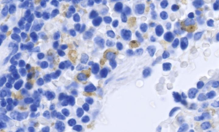 Mouse spleen cells infected with Zika virus. Infected cells are shown in brown, cell nuclei in blue. Courtesy of the Shresta lab at La Jolla Institute for Allergy and Immunology