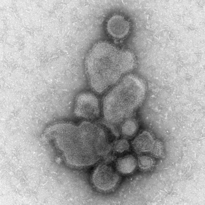 H7N9 avian influenza/ Cynthia S. Goldsmith and Thomas Rowe-CDC