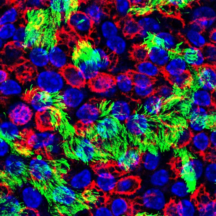 Cells of the upper respiratory tract are where influenza virus infection occurs. Red marks basal cells, green marks ciliated cells, and blue marks cell nuclei. Image/Rebekah Dumm, Duke University