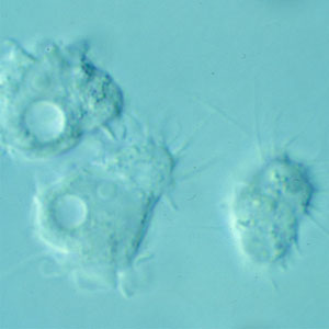 Acanthamoeba trophozoites Image/CDC-DPDx