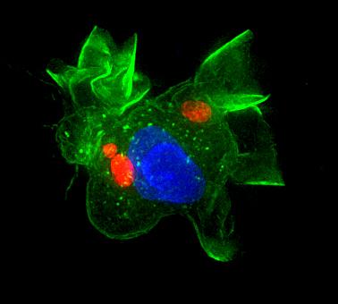 Image illustrate dendritic cell (green) infected by Toxoplasma gondii (red). Cell nuclei are stained in blue. Image/Barragan lab