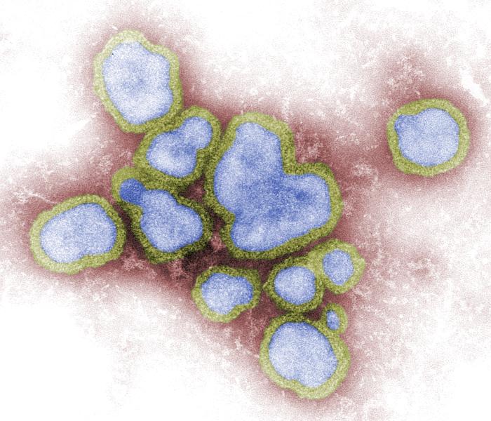  Influenza A virions Image/CDC