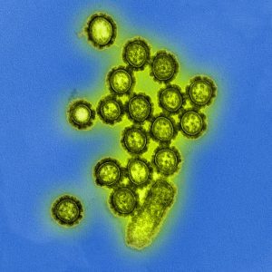 H1N1 influenza virus particles/National Institute of Allergy and Infectious Diseases (NIAID)
