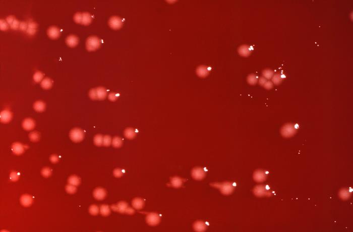 Citrobacter freundii bacteria cultivated on a blood agar plate (BAP). Image/CDC