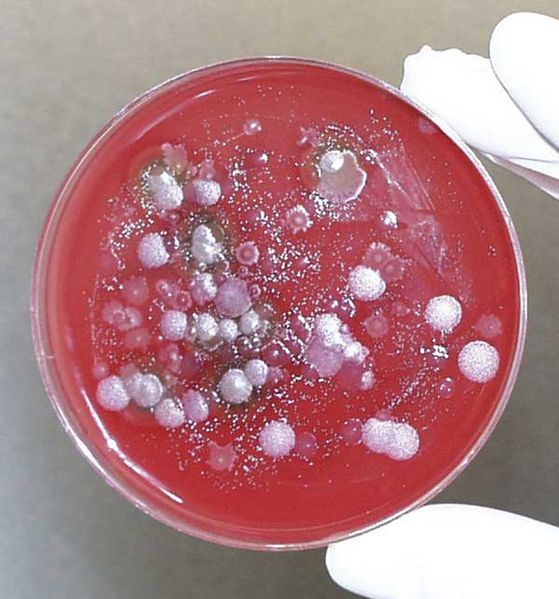 Bacillus anthracis Bioterrorism Incident, Kameido, Tokyo, 1993, Fluid collected from the Kameido site cultured on Petri dishes to identify potential Bacillus anthracis isolates/ CDC
