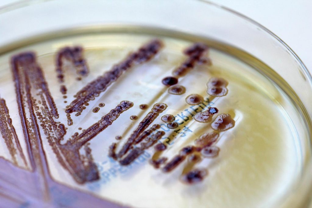 Long test procedures such as cultivation on agar may soon be a thing of the past when testing patients for multi-resistent pathogens. Image/University of Cologne