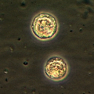 Cyst of Balamuthia mandrillaris Image/CDC