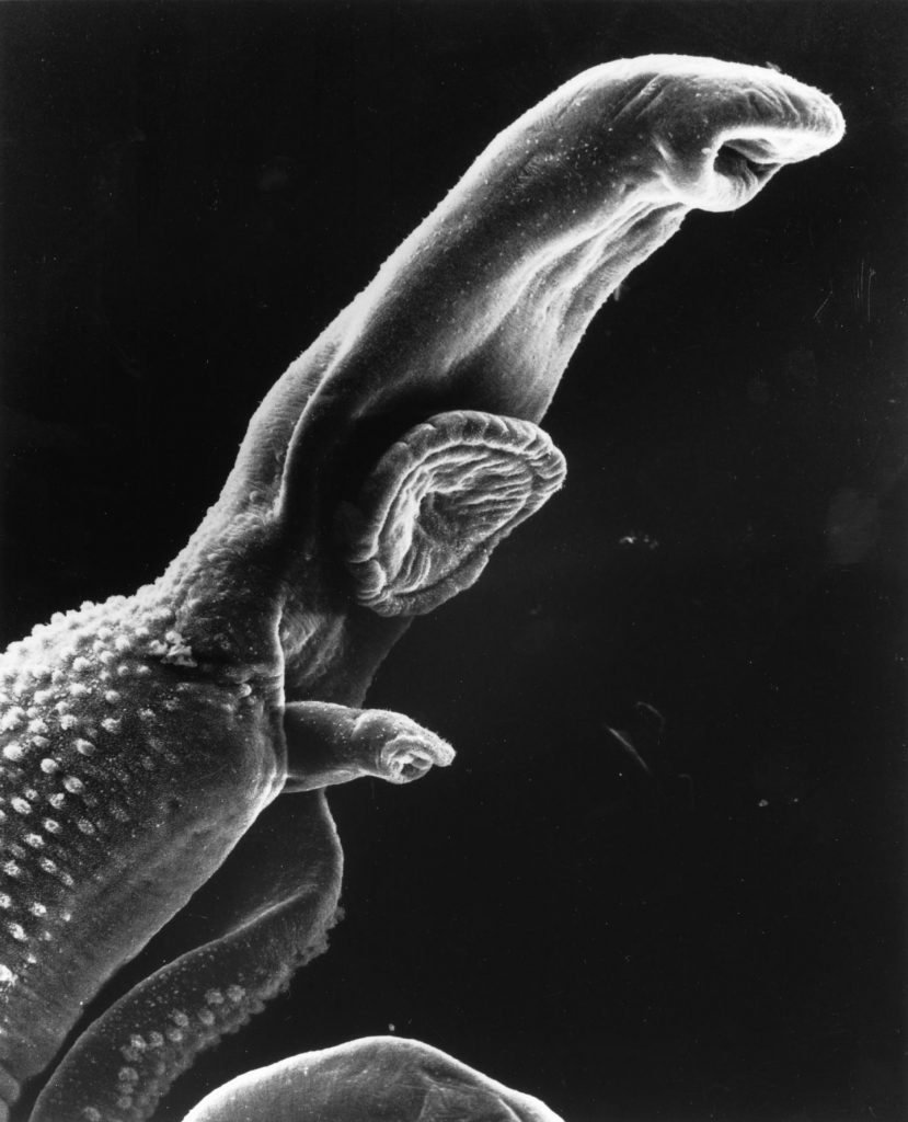 Schistosome Parasite Image/Wetzel and Shaefer, Wikimedia Commons, Public Domain, 2001