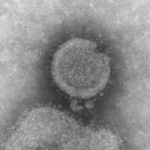 H7N9 avian influenza Image/CDC