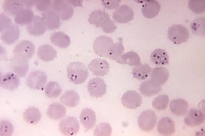 Plasmodium falciparum/CDC