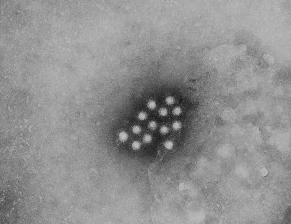Hepatitis A Image/CDC