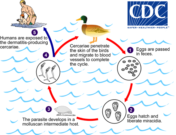 Swimmer's Itch Life Cycle/CDC, DPDx