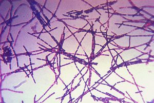 Bacillus anthracis bacteria using Gram-stain technique