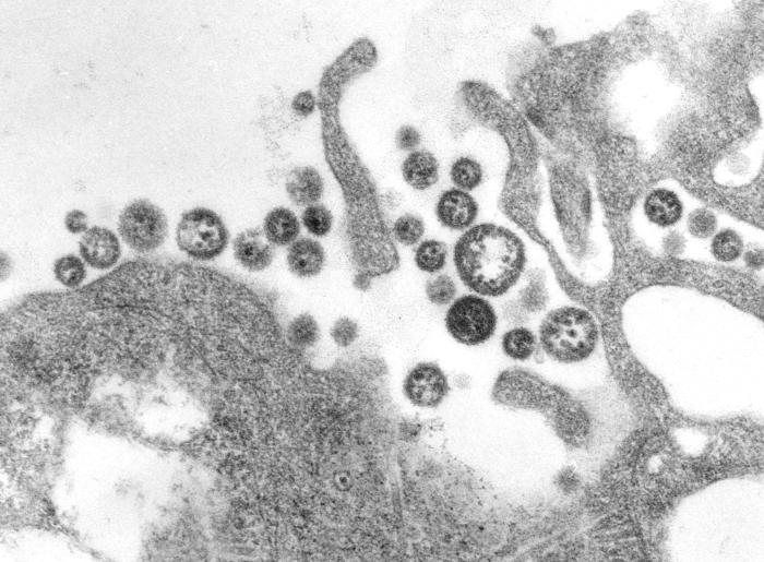 This transmission electron micrograph (TEM) depicted numbers of Lassa virus virions adjacent to some cell debris. Image/C. S. Goldsmith