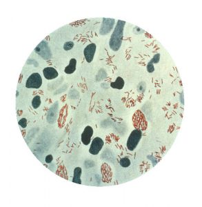 Mycobacterium leprae/CDC