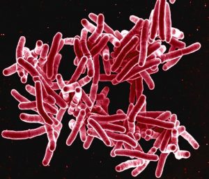 Mycobacterium tuberculosis bacteria/CDC
