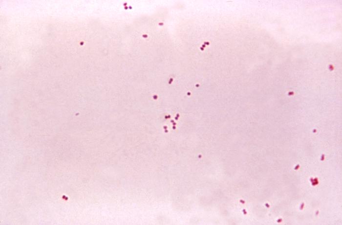    Gram-negative diplococcal bacteria Neisseria meningitidis / CDC 