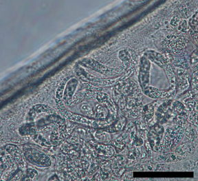 Dirofilaria repens microfilaria inside the uterus of an adult female worm/CDC-Sven Poppert et al