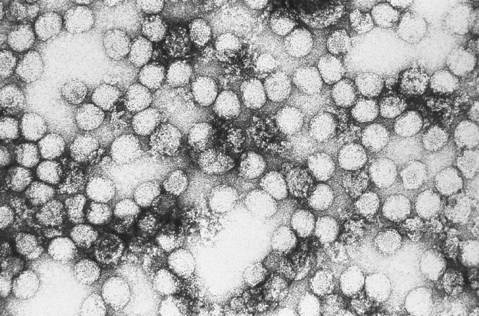 Yellow Fever Virus virions/CDC