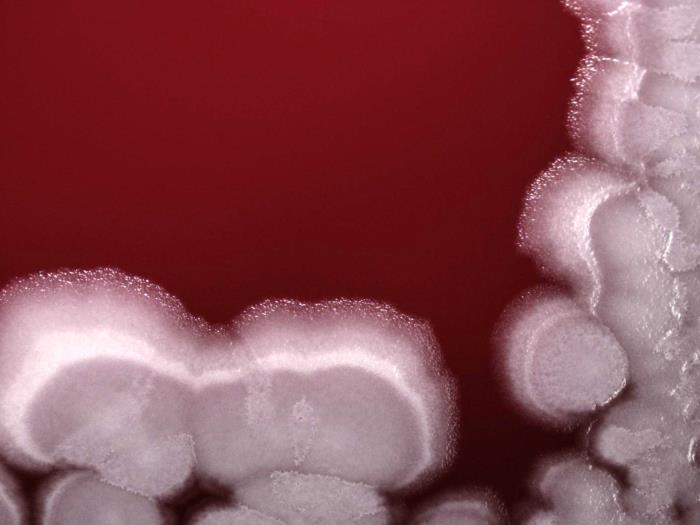 Bacillus anthracis/CDC