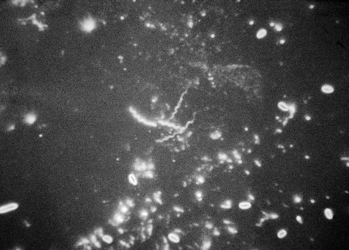 Treponema carateum bacteria obtained from an early pinta lesion/CDC