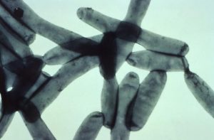 Legionella pneumophila bacteria/CDC