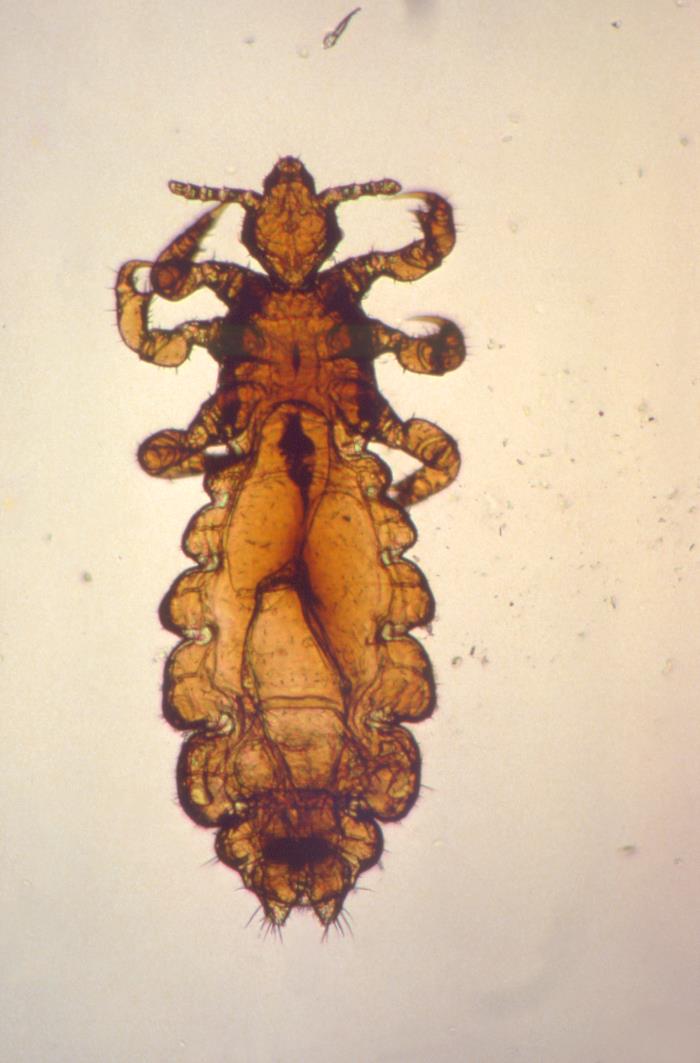 Самка головной вши рисунок. Pediculus humanus humanus самец. Головная и платяная вошь под микроскопом. Самка Pediculus humanus capitis.