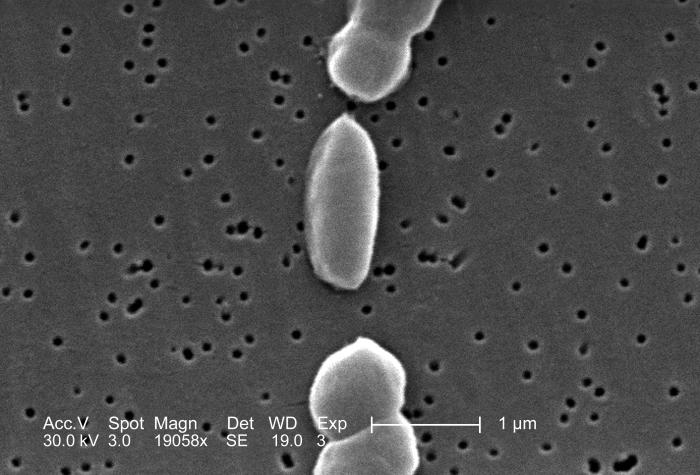 Vibrio parahaemolyticus/CDC