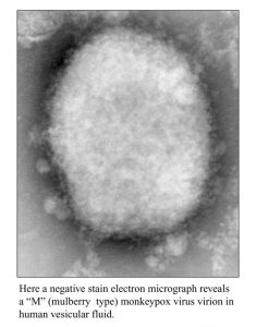 Monkeypox virus/CDC