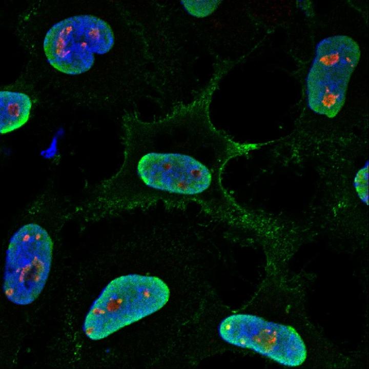 Infection of human cells with Hendra virus (green) is critically dependent on fibrillarin (red), a host protein that resides deep within the cell nucleus (blue). Image/Deffrasnes et al.