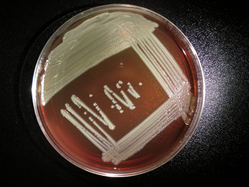 Elizabethkingia anophelis growing on a blood agar plate. Image/CDC's Special Bacteriology Reference Lab