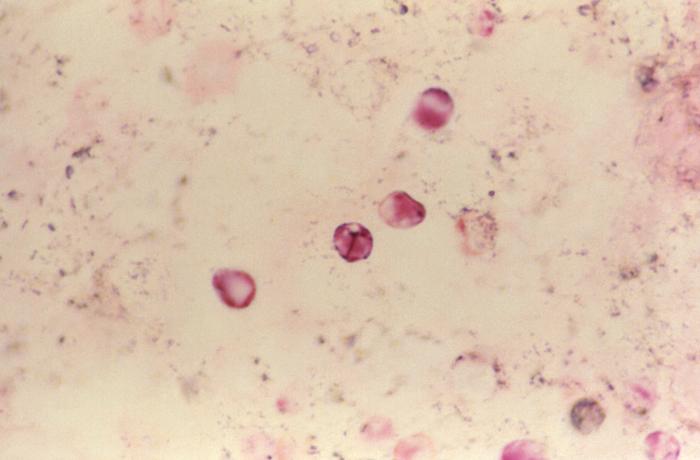Pneumocystis Image/CDC
