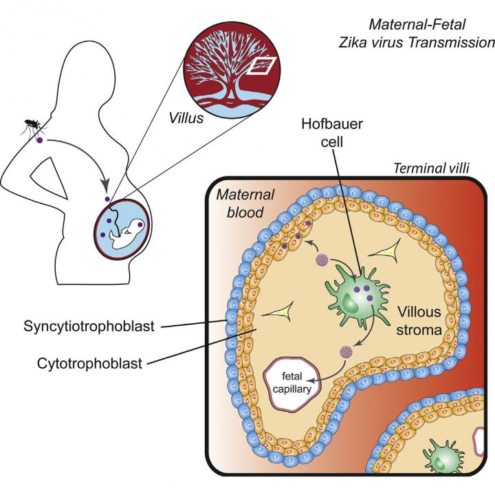 This visual abstract depicts the findings of Quicke et al., who demonstrate that a contemporary ZIKV strain infects and replicates in primary human placental macrophages and cytotrophoblasts, suggesting a route for ZIKV to cross the placental barrier. Image/Quicke and Bowen et al./Cell Host & Microbe 2016