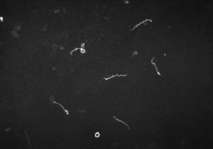 Treponema pallidum spirochetes in darkfield exam/CDC