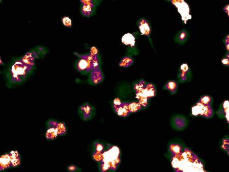 Immune molecule IL-1beta (the "hot spots" shown here) senses bacterial infections. Image/UC San Diego Health