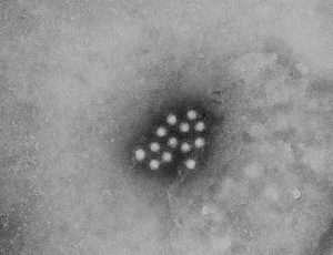 Hepatitis A/CDC