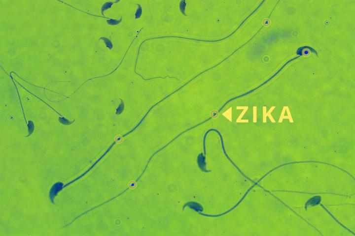 A new study shows that Zika targets the male reproductive system, at least in mice. Three weeks after Zika infection, male mice had shrunken testicles, low levels of sex hormones and reduced fertility, and their sperm remained infected with the virus, as shown above. The results suggest that Zika infection may interfere with men's ability to have children, but additional studies are needed. CREDIT Prabagaran Esakky/Eric Young