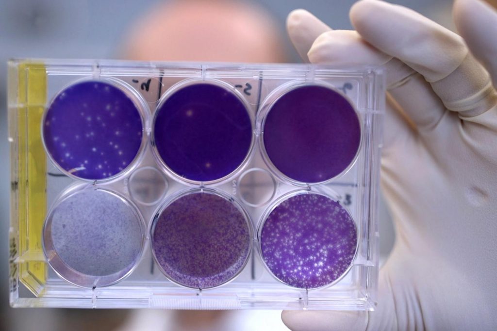 A researcher holds a tray of Zika virus growing in animal cells at Washington University School of Medicine in St. Louis. There is no treatment available to block Zika virus in a pregnant woman from infecting her fetus and potentially causing severe birth defects. But researchers have identified a human antibody that prevents, in pregnant mice, the fetus from becoming infected and the placenta from being damaged. The antibody also protects adult mice from Zika disease. Image/Huy Mach