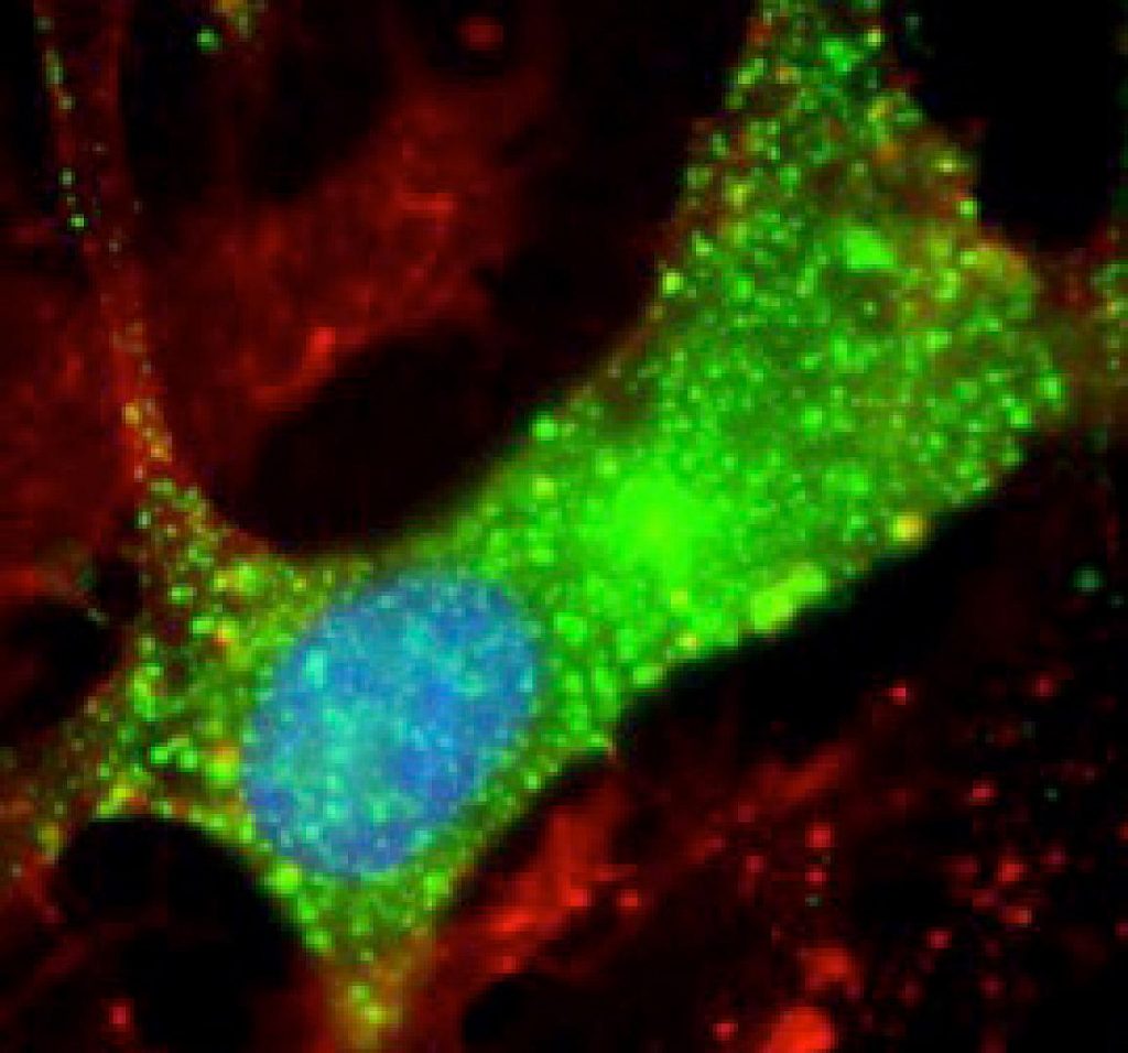 New clues to Nodding syndrome - NIH scientists discovered antibodies to leiomodin-1 (green) inside human brain cells. This study suggests that Nodding syndrome may be an autoimmune disease. -Avindra Nath, M.D., NINDS.