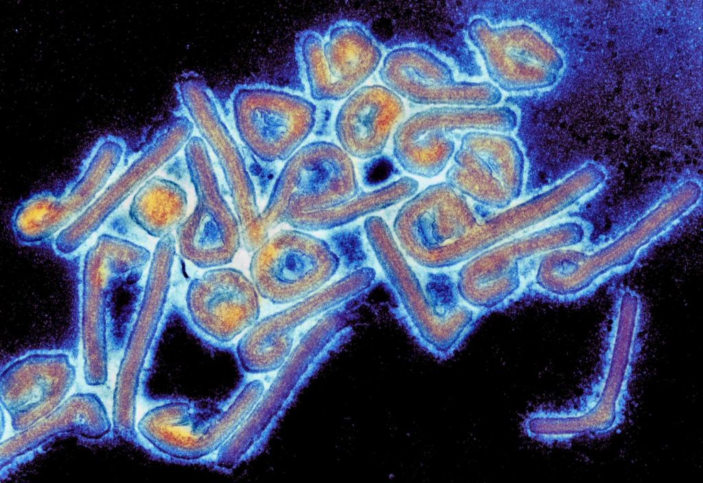 This is a colorized electron micrograph of the Marburg virus. Image courtesy of Dr. Tom Geisbert, University of Texas Medical Branch