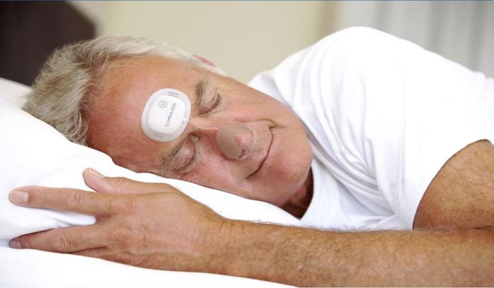 Results of a definitive clinical trial show that a new, disposable diagnostic patch effectively detects obstructive sleep apnea across all severity levels. Image/Somnarus, Inc.