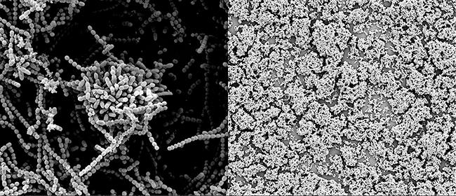 The close-up image on the left illustrates how Strep bacteria normally clump together to form a protective biofilm. The image of the right shows that the biofilm breaks down when a Strep culture is dosed with human milk sugars, exposing more of the bacteria to attack by antibacterial agents. Image/Steven Townsend, Vanderbilt University