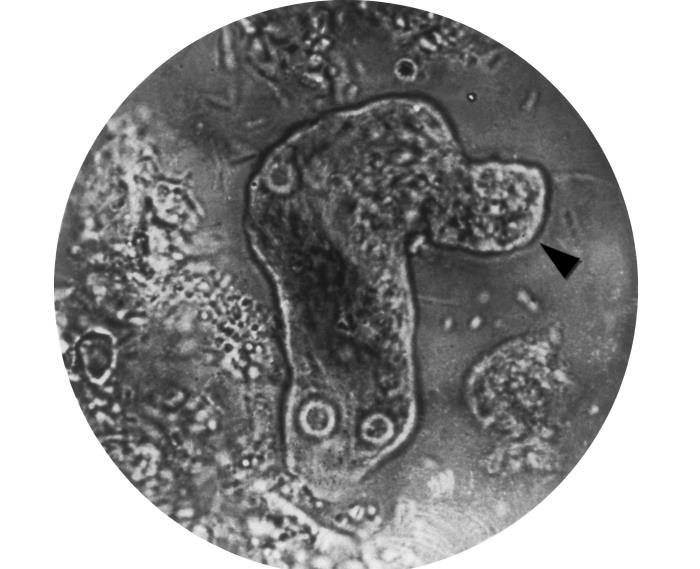 This photomicrograph of a living Entamoeba histolytica parasitic trophozoite reveals the method by which this organism moves. Image/CDC, AFIP