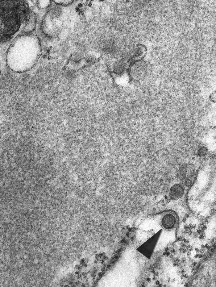 Rabies virus Image/CDC