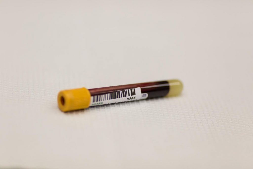 Blood samples were drawn from US Olympic and Paralympic athletes and staff before and after the Rio Games in 2016. Image/Charlie Ehlert, University of Utah Health