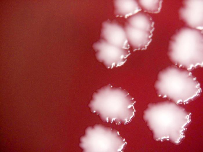 Yersinia pestis Image/CDC