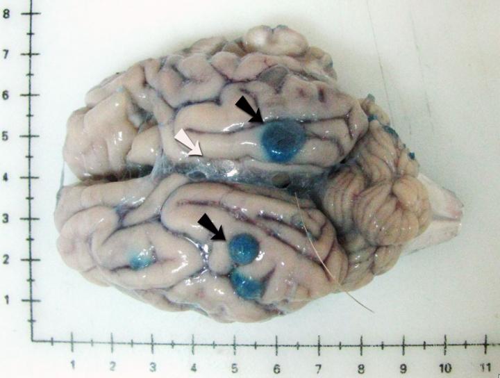 Pig brain naturally infected with Taenia solium five days after praziquantel treatment and infused Evans blue prior to necropsy. The black arrows point to blue cysts with increased vascular permeability in surrounding tissues; a clear cyst with unaltered vascular permeability in surrounding tissues is indicated with a white arrow. Image/Dr. Cristina Guerra-Giraldez, 2015
